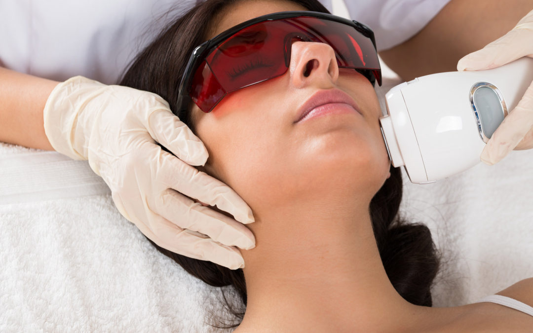 ipl hair removal treatment